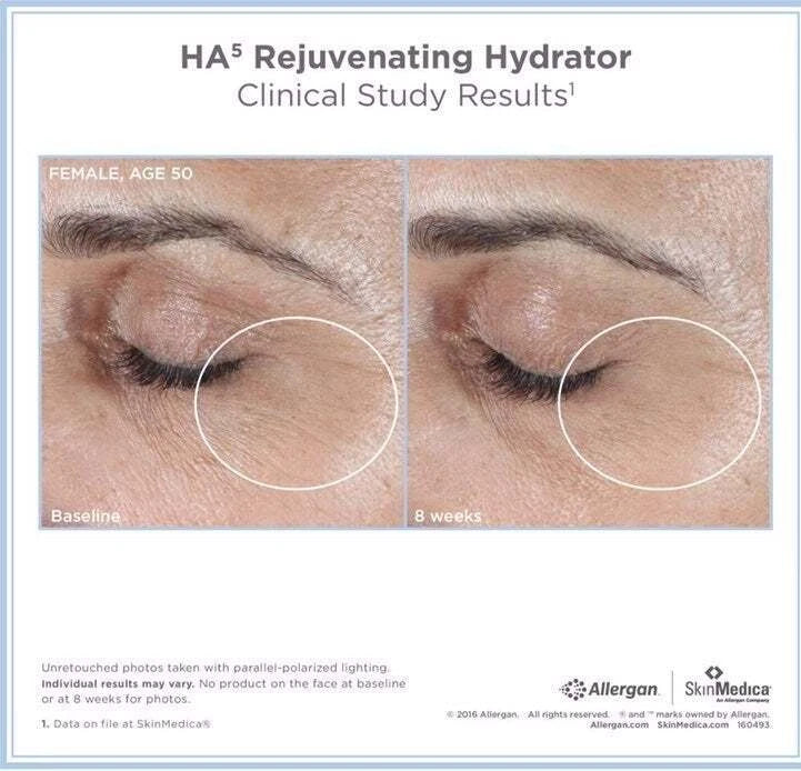 SkinMedica HA5 Rejuvenating Hydrator 2 oz / 56.7 g | New Sealed | Authentic